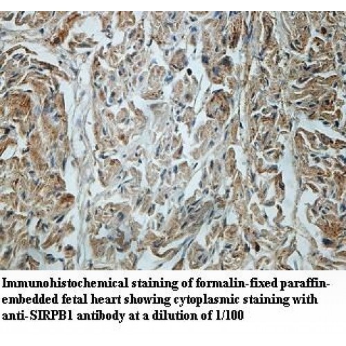 SIRPB1 Antibody