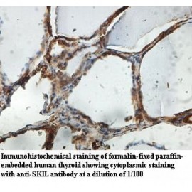 SKIL Antibody