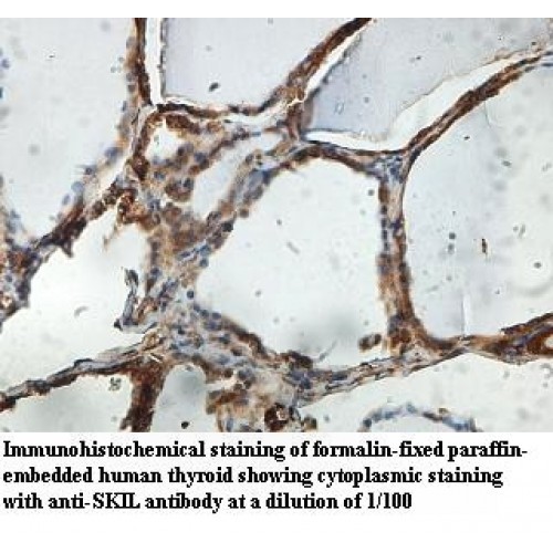 SKIL Antibody