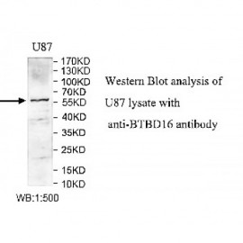 BTBD16 Antibody