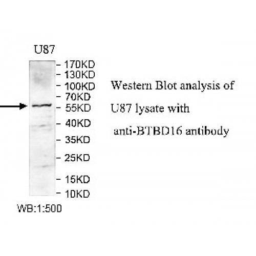 BTBD16 Antibody