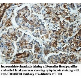 C10orf88 Antibody