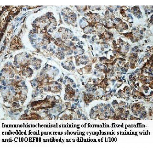 C10orf88 Antibody