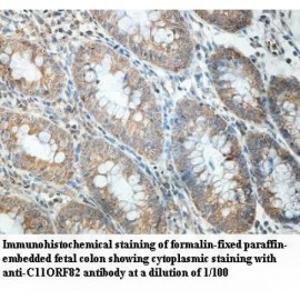 C11orf82 Antibody