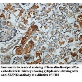 SLFN12 Antibody