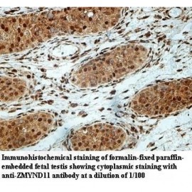 ZMYND11 Antibody