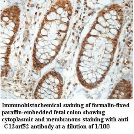 C12orf52 Antibody