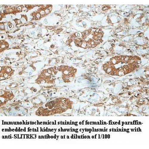 SLITRK3 Antibody