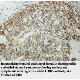 SLITRK5 Antibody