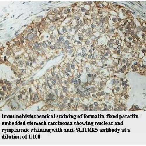 SLITRK5 Antibody