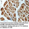 ACTG1 Antibody