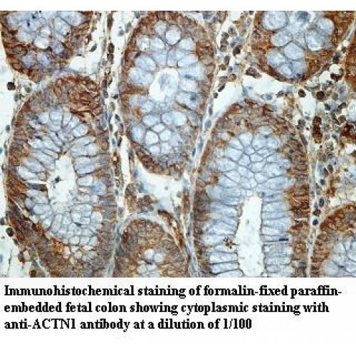 ACTN1 Antibody