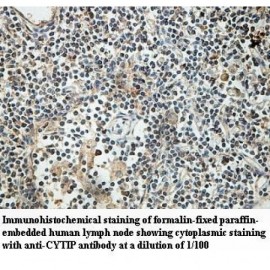 CYTIP Antibody
