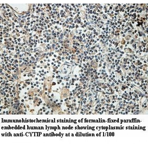 CYTIP Antibody