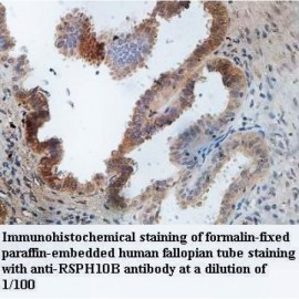 RSPH10B Antibody