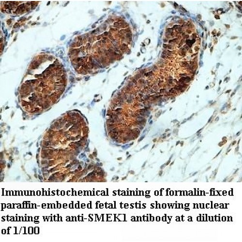 SMEK1 Antibody