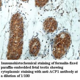 ACP1 Antibody