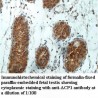 ACP1 Antibody