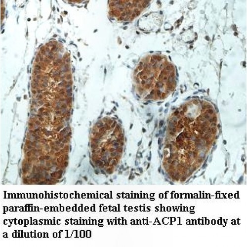 ACP1 Antibody