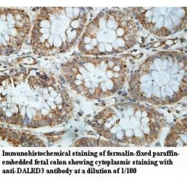 DALRD3 Antibody