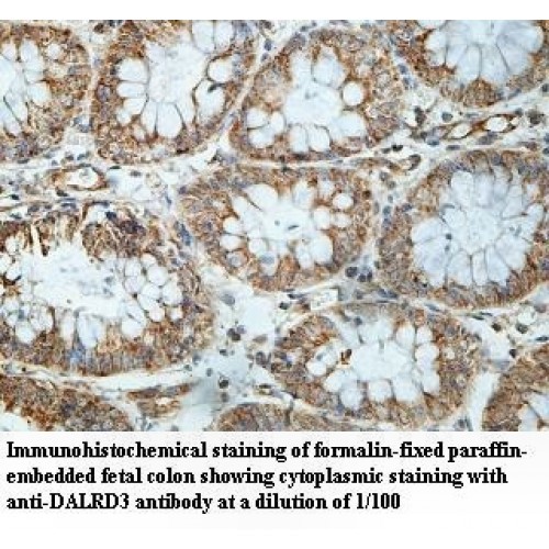 DALRD3 Antibody