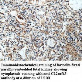 C12orf43 Antibody