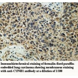 CYP4B1 Antibody