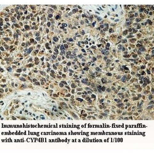 CYP4B1 Antibody
