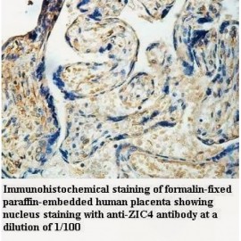 ZIC4 Antibody