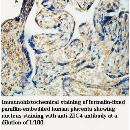 ZIC4 Antibody