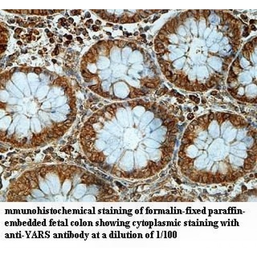 YARS Antibody