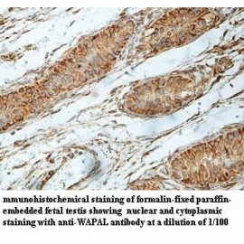 WAPAL Antibody