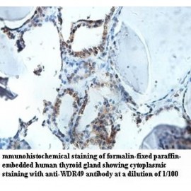 WDR49 Antibody