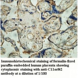 C11orf42 Antibody
