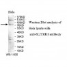 SLITRK1 Antibody