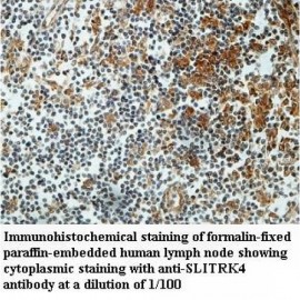 SLITRK4 Antibody
