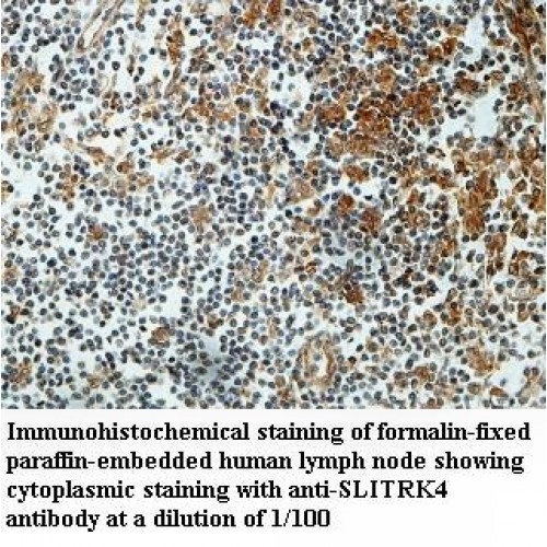 SLITRK4 Antibody