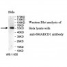 SMARCD1 Antibody