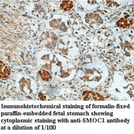 SMOC1 Antibody