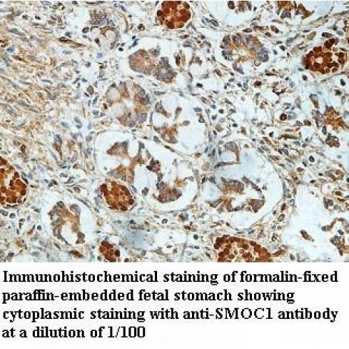 SMOC1 Antibody