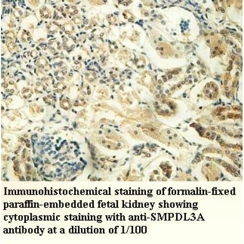 SMPDL3A Antibody