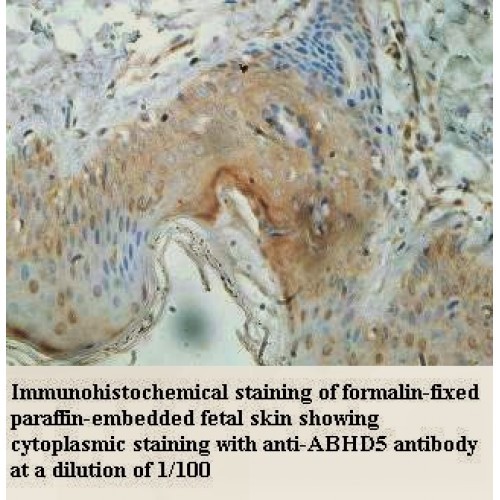 ABHD5 Antibody