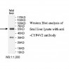 CYP4V2 Antibody