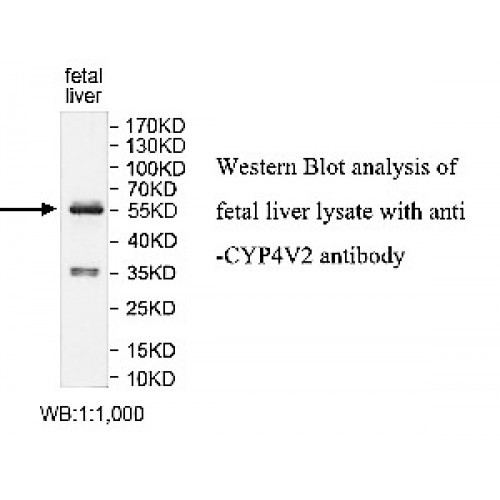 CYP4V2 Antibody