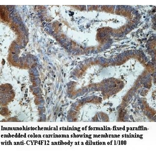 CYP4F12 Antibody