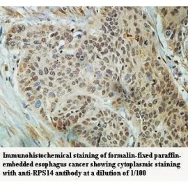 RPS14 Antibody