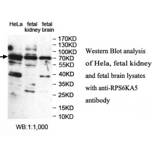 RPS6KA5 Antibody
