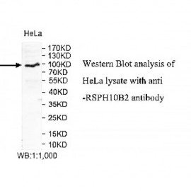 RSPH10B2 Antibody