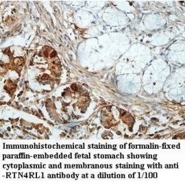 RTN4RL1 Antibody