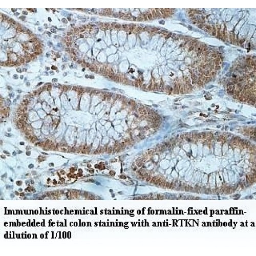 RTKN Antibody
